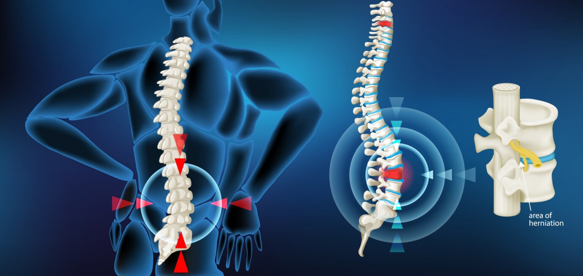 Saksham Ayurveda - Finding Relief and Balance - Exploring Ayurveda for Spine and Joint Health